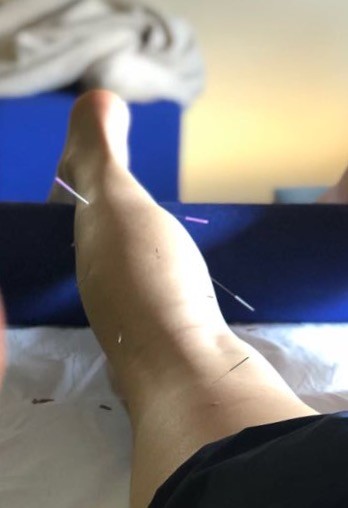 Lisa Zimmermann Freeski Blog: RedBull Reha-Zentrum